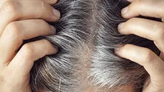 Did you know that gray hair is actually a sign of good health?