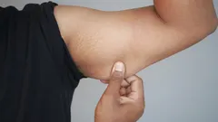 How to Get Rid of Flabby Arms with At-Home Exercises: Simple Tips You Can Start Using Today